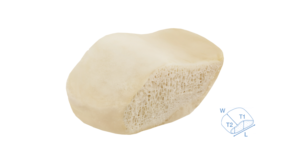 sterigraft-patellar-block