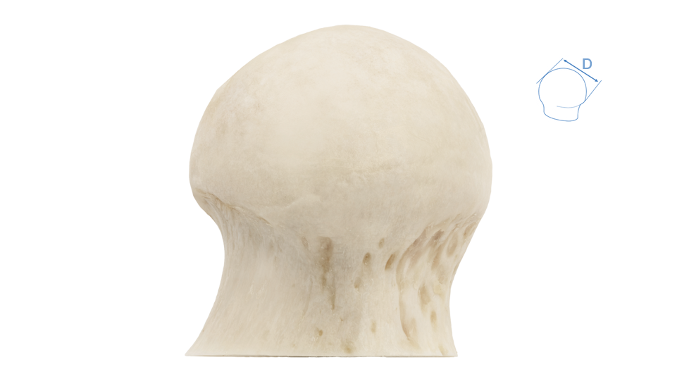 femoral-head