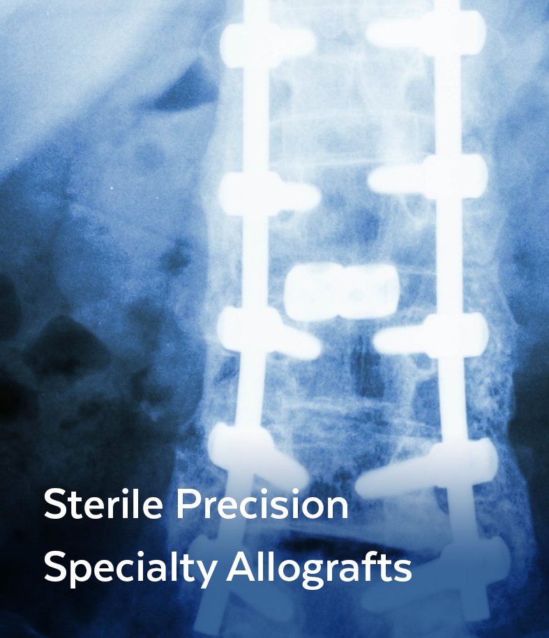 homespacer-sterile-precision-specialty-allografts