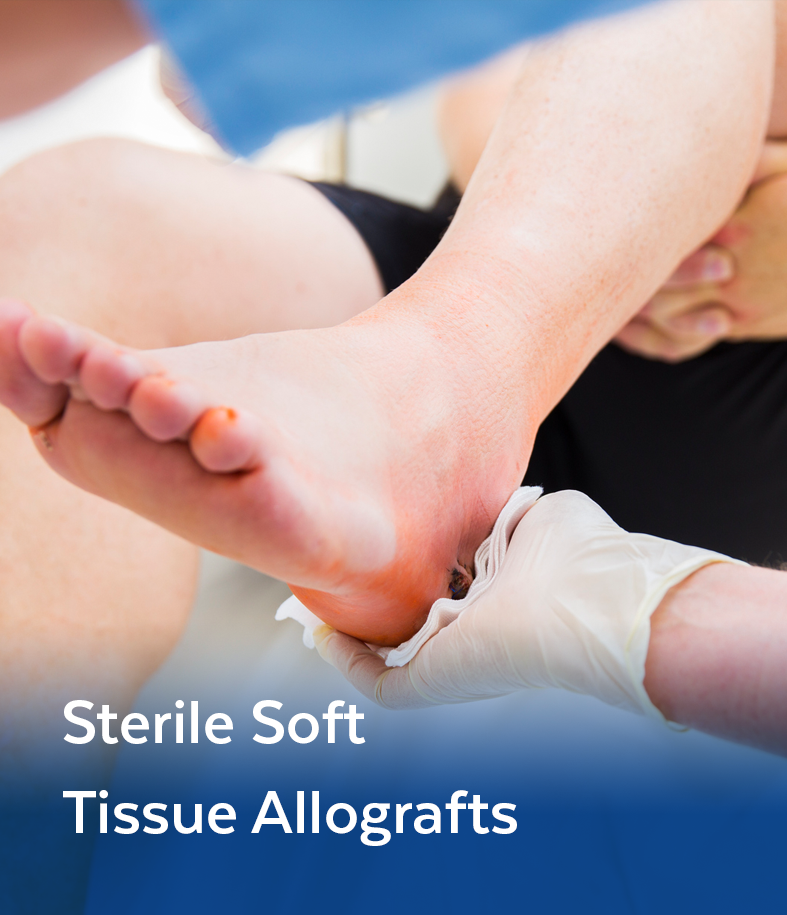 homespacer-sterile-soft-tissue-allografts